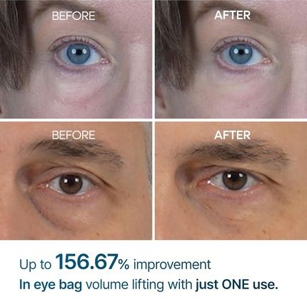 Eyephalt Eyebag Cream For Puffiness, Dark Circles & Fine Lines - Image 3