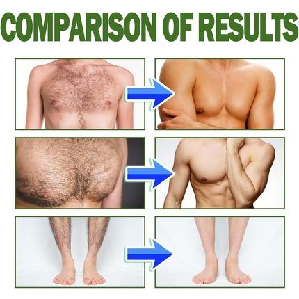Man Hair Removal Cream With Natural Aloe Vera - Quick And Gentle Hair Remover - Image 3