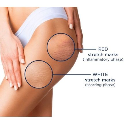 Rilastil Stretch Marks Cream 200Ml - Image 3