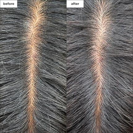 Briogeo Scalp Revival Charcoal Tea Tree Cooling Hydration Scalp Mask - Image 3