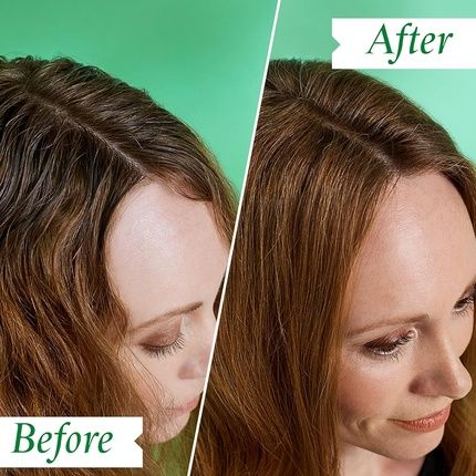 Philip Kingsley Flaky Scalp Shampoo For Flaky Dry Oily Scalps Cleansing Scalp Care Hair Products Soothing Soothes And Calms 75Ml - Image 3