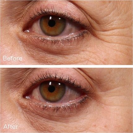 Murad Resurgence Retinol Youth Renewal Anti-Aging Firming Face & Eye Serum Creams Retinol Tri-Active Technology All Skin Types