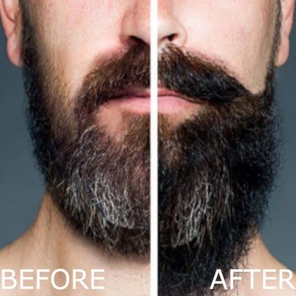 Arlo'S Pro-Growth 2-In-1 Beard Wash And Conditioner Vanilla Sandalwood With Menthol 12Oz