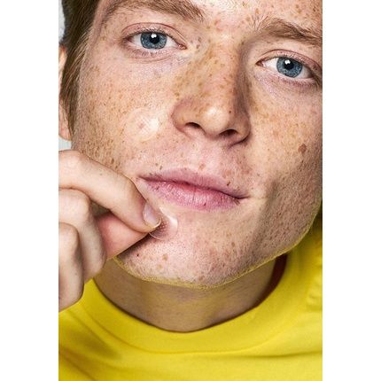 Zitless Microdart Patches For Early-Stage Pimples - Pack Of 5