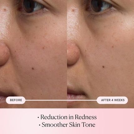 Elemis Pro-Collagen Rose Micro Serum Hydration Serum For Plumping, Soothing, And Nourishing Skin - Reduce Fine Lines And Wrinkles - Image 3