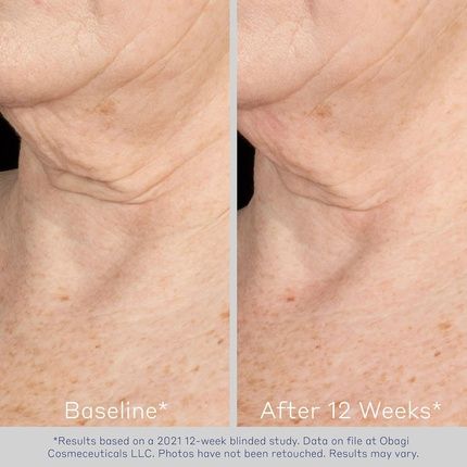 Obagi Elastiderm Neck & Decollete Lifting Concentrate With Patented Bi-Mineral