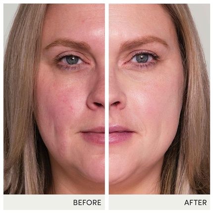 Jane Iredale Hydropure Tinted Serum Hydrating Sheer Coverage Formula With Hyaluronic Acid And Coq10 Green - Image 3