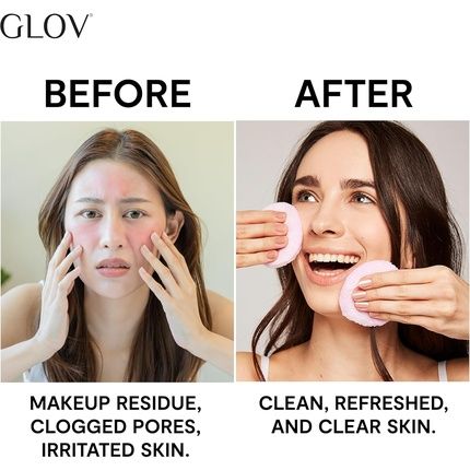 Reusable Makeup Remover Pads Washable Face Cleaner And Eye Makeup Remover Pads - Image 3