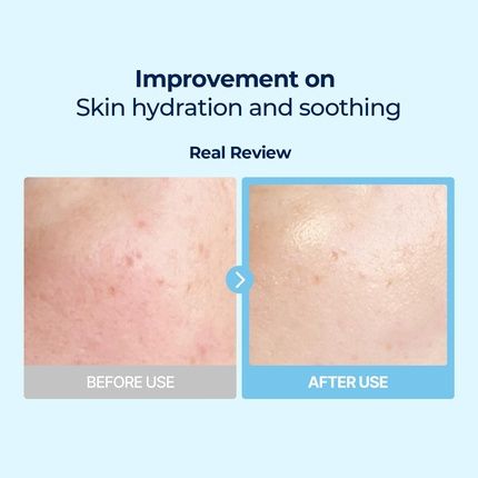 Torriden Dive-In Vegan Hyaluronic Acid Toner Pads For Face Moisturizing Facial Cooling Soothing Hydrating Spot Masking Alcohol-Free Fragrance-Free No Colorants Cruelty-Free - Image 3