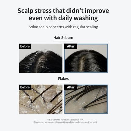 Growus Sea Salt Therapy Scalp Scaler With Salicylic Acid And Niacinamide - Image 3