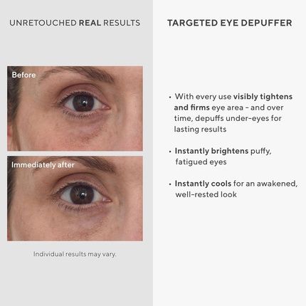 Murad Targeted Eye Depuffer 0.5 Fl Oz - Image 3