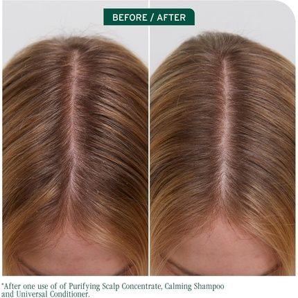 Biolage Scalp Sync Purifying Scalp Concentrate Balances Scalp Moisture - Image 3