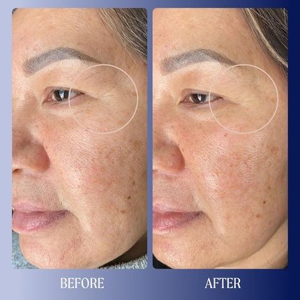 Kinship Dreamwave 2% Bio-Retinoid Overnight Renewal Serum - Retinol - Image 3