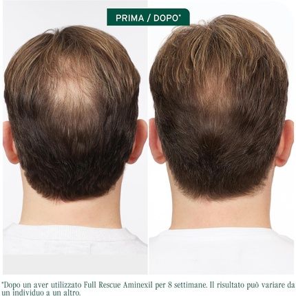 Biolage Anti-Hair Loss Treatment In Vials For Fine Hair - Image 3