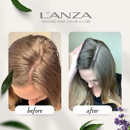 L'Anza Healing Remedy Scalp Balancing Cleanser - Restores Wellness To Hair