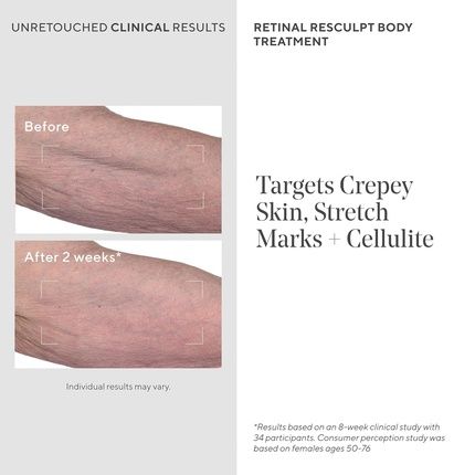 Retinal Resculpt Body Treatment - Retinal Body Cream To Target Cellulite - Image 3