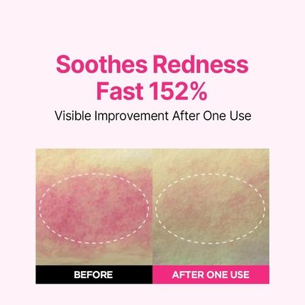 Isoi Blemish Care Up Serum Vegan Hydrating Serum For Smooth & Glass Skin - Image 3