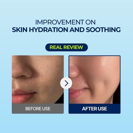 Torriden Dive-In Hyaluronic Acid Facial Sheet Masks Moisturizing Sheet Mask For Sensitive Dry Skin Fragrance-Free Alcohol-Free No Colorants Vegan Cruelty-Free Korean Skin Care - Image 3