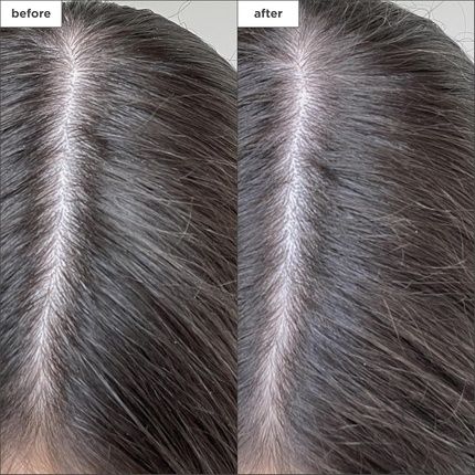 Briogeo Scalp Revival Charcoal Biotin Dry Shampoo To Absorb Oil - Image 3