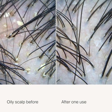 Living Proof Scalp Care Exfoliator 3.4 Fl Oz