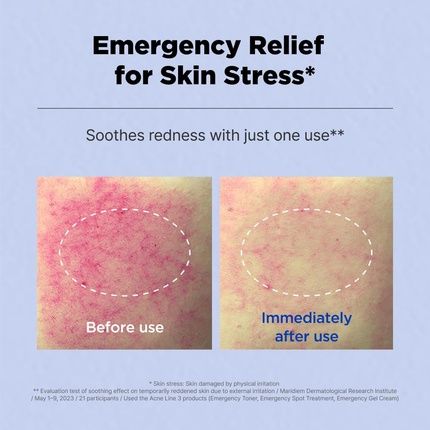 Isoi Acni Dr. 1St Control Tonic Plant-Based Soothing Formula For Oily Skin - Image 3