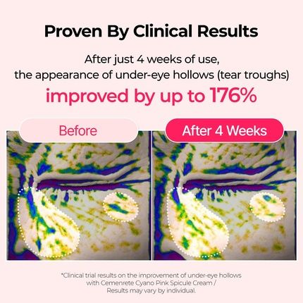 Cemenrete Cyano Pink Spicule Serum With Calcium And Vitamin B12 For Under Eyes - Image 3