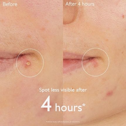 Caudalie Vinopure Salicylic Spot Solution 15Ml - Image 3